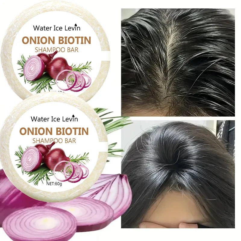 Onion & Biotin Shampoo Bar|