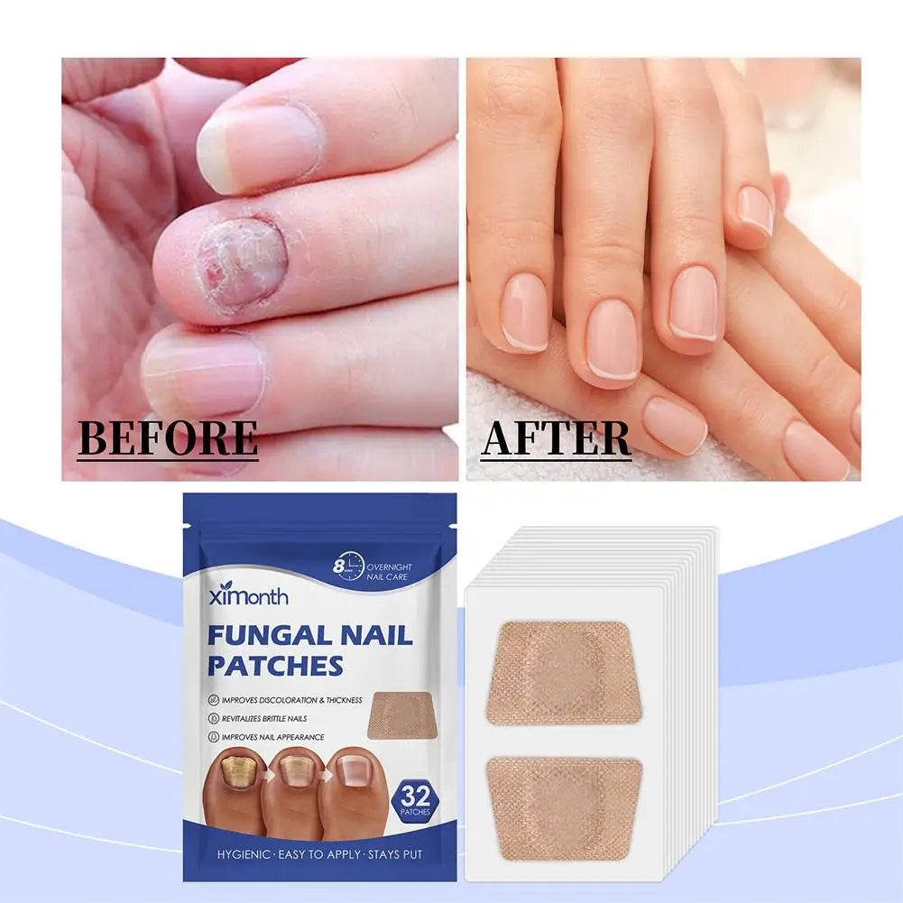 Fungal Nail Repair Patches – Anti-Infection Nail Treatment (1–3 PCS)